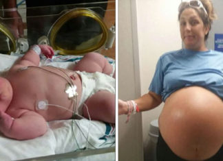 Doctors amazed after mom gives birth to a 13lb baby
