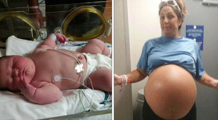 Doctors amazed after mom gives birth to a 13lb baby