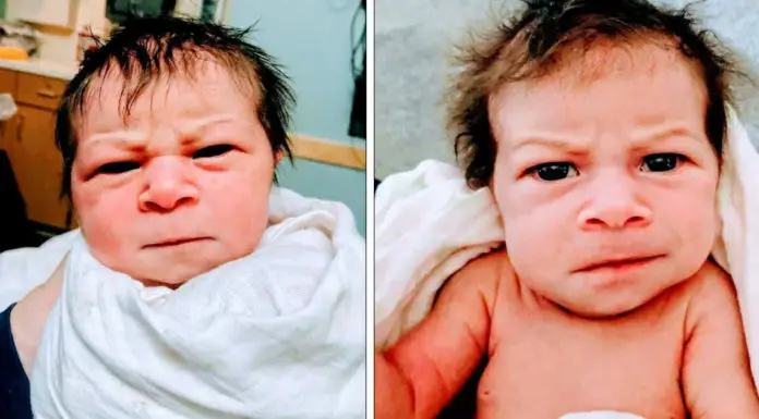 Pregnant mom diagnosed with worrying condition gives birth to “angry” baby