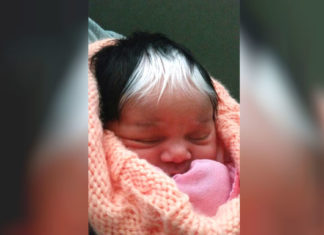 Baby born with white patch of hair is winning the internet