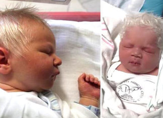 Baby boy born with snow-white hair dubbed “Prince Charming”