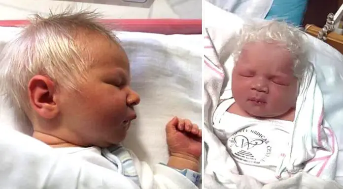 Baby boy born with snow-white hair dubbed “Prince Charming”