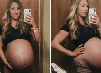 Mom of Quadruplets posts before-and-after photos of her belly to shows how amazing the female body is