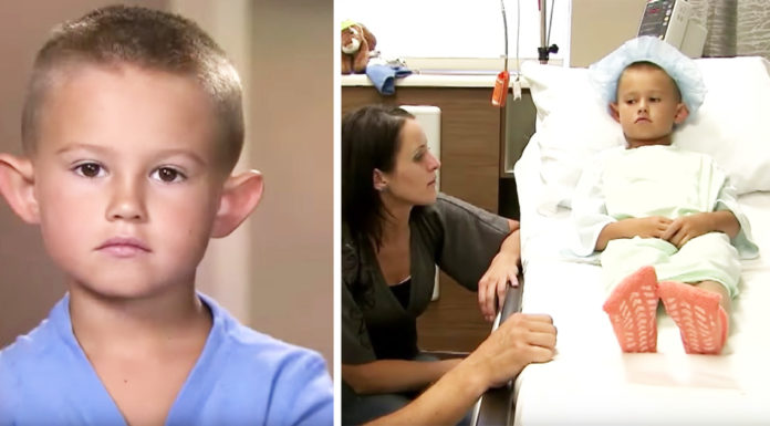 Parents provide their 6-year-old son with surgery after he falls victim to bullying because of his big ears