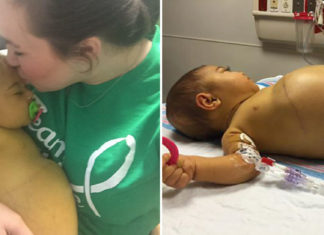 Little Braylee’s story shows how life-changing an organ donation can be