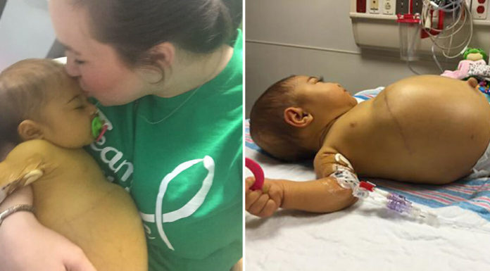 Little Braylee’s story shows how life-changing an organ donation can be
