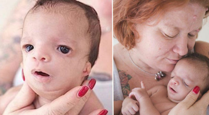 Woman gives birth to a baby daughter with rare condition and is puzzled when adoptive family won’t take her