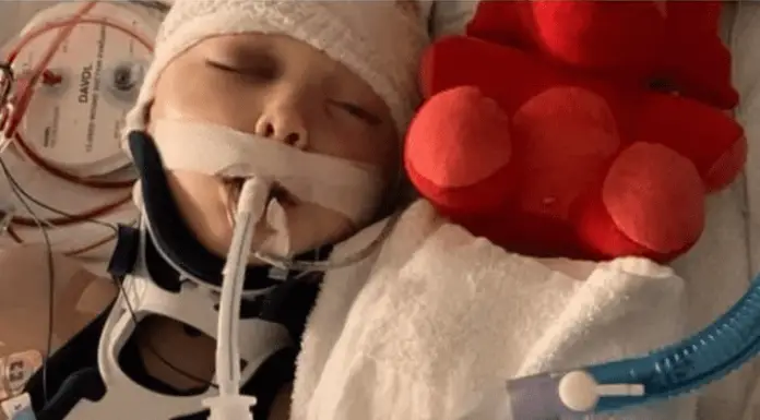 7-year-old is left with a hole in his skull after a neighbor attacks him by hurling rocks at him