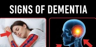 Signs of dementia you should never ignore and habits you should start today to prevent it before it’s too late
