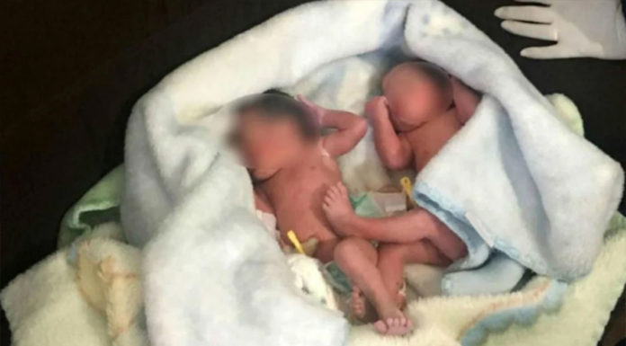 Women hear whining coming from a bush believing someone abandoned puppies – discover twin newborn babies instead