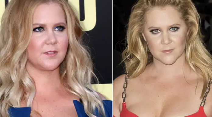 Comedian Amy Schumer on her pregnancy, breastfeeding, and losing weight after giving birth