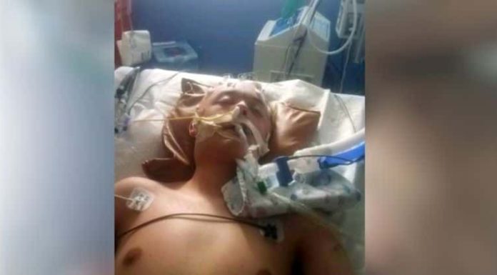 16-year-old boy left with a fractured skull and severe brain injury after being beaten by a bully at school