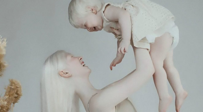 Two albino sisters from Kazakhstan born 12 years apart become modeling sensation