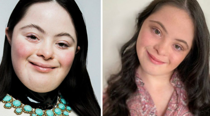 Ellie, an 18-year-old model with Down syndrome, stars in Gucci’s new beauty campaign