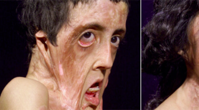 The incredible story of Zubaida Hasan from Afghanistan