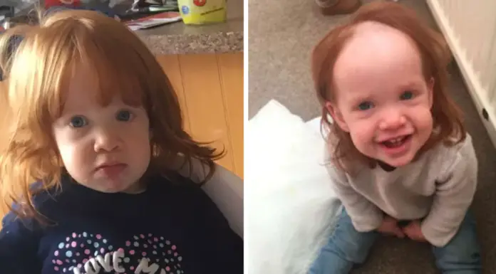 Toddler looks like Pennywise from It after applying hair removal cream on her head