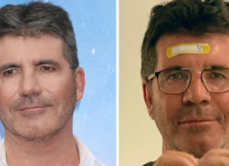 News on Simon Cowell’s health following electric bike accident