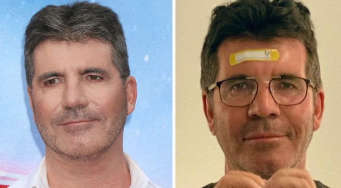 News on Simon Cowell’s health following electric bike accident