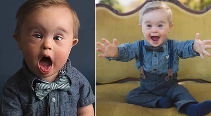 Modeling agency rejects a 15-month-old boy because he has Down Syndrome
