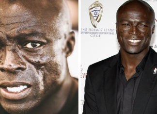 Seal opens up about his facial scars which became his trademark over the years