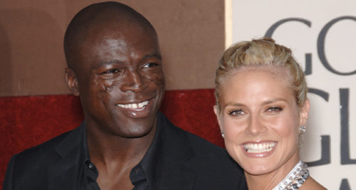 Seal opens up about his facial scars which became his trademark over ...