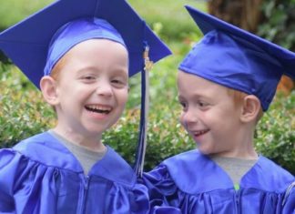 Formerly conjoined twins reach a special milestone