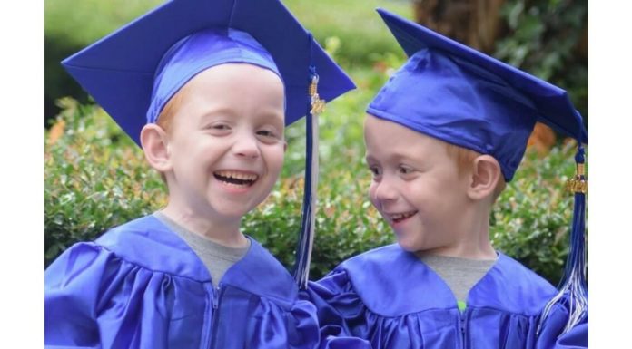 Formerly conjoined twins reach a special milestone