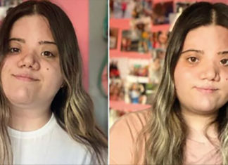 20-yr-old bullied for condition which affects her face takes to social media to address online bullying