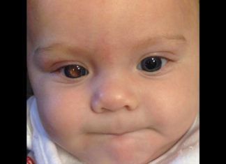 Mom knows 4-month-old son has cancer after taking a photo of him