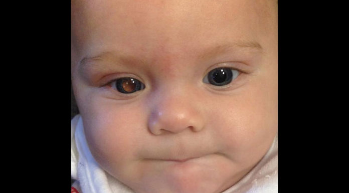 Mom knows 4-month-old son has cancer after taking a photo of him