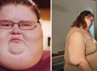 This is what Ashley Bratcher from ”My 600-Lb Life” looks like today