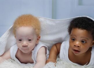 Mom of black and white boys often gets asked which one of them is hers