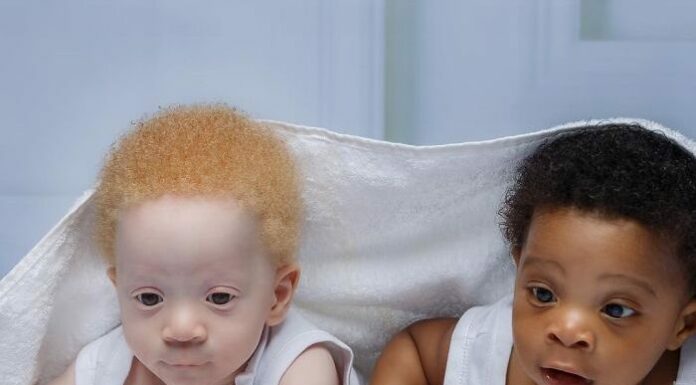 Mom of black and white boys often gets asked which one of them is hers