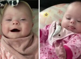 Florida mom gives birth to rare set of identical twins with Down syndrome