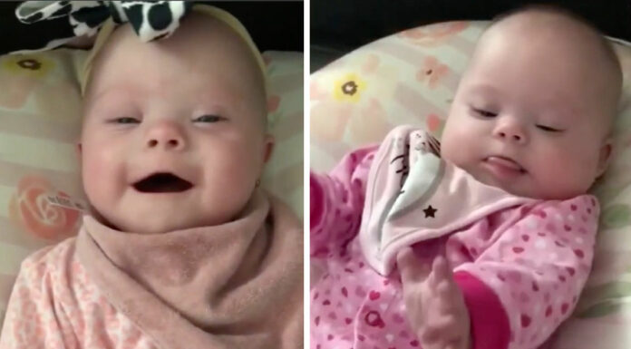 Florida mom gives birth to rare set of identical twins with Down syndrome