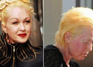 Sad news about the beloved singer Cyndi Lauper
