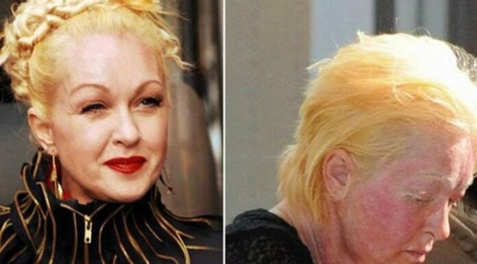 Sad news about the beloved singer Cyndi Lauper