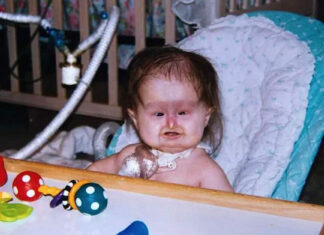 Mom notices something’s wrong when giving birth – 25 years later her daughter is still mistaken for a child