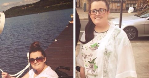 Woman’s foot has been swollen for years, then she finally pays the doctor a visit to learn why