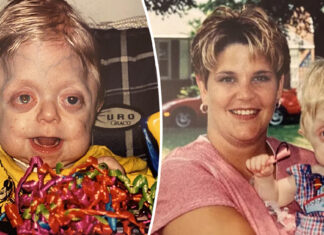 Teen who wasn’t expected to live past 18 months graduates high school – well done, Braden