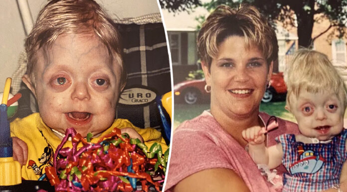 Teen who wasn’t expected to live past 18 months graduates high school – well done, Braden