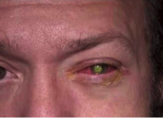 He lost his sight as a result of a nightly blunder we all commit!