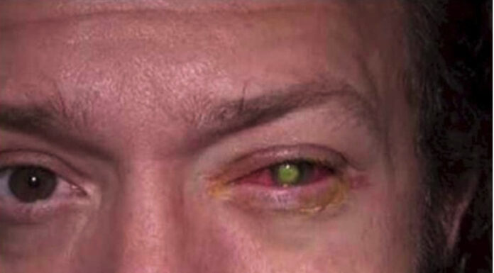 He lost his sight as a result of a nightly blunder we all commit!