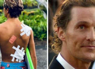 Matthew McConaughey displays his son’s serious surf injuries as ‘souvenirs’