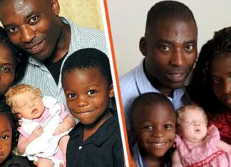 ‘A miracle baby’: Black couple gives birth to a blond, blue-eyed child and doctors are in awe