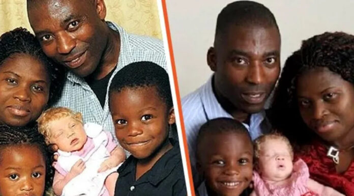 ‘A miracle baby’: Black couple gives birth to a blond, blue-eyed child and doctors are in awe
