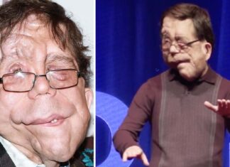 The extraordinary life of Adam Pearson: The actor with a genetic disorder who didn’t let anyone stand in his way