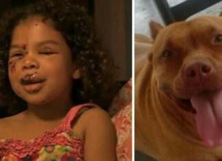5-year-old gets bitten by neighbor’s Labrador – this sets off the family pit bull who does the unimaginable
