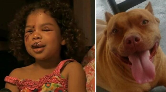 5-year-old gets bitten by neighbor’s Labrador – this sets off the family pit bull who does the unimaginable