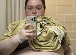 ‘It felt like my organs were being crushed,’ said a 20-year-old woman from Florida after having a 100-pound ovarian cyst